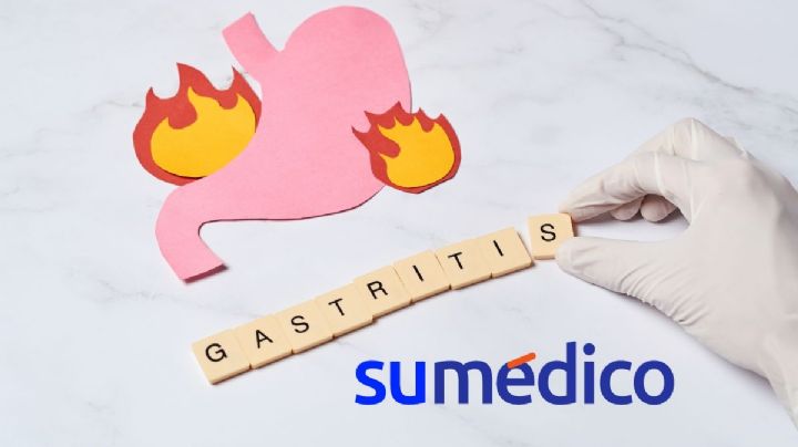 ¿Cuáles son los síntomas de gastritis nerviosa por estrés?