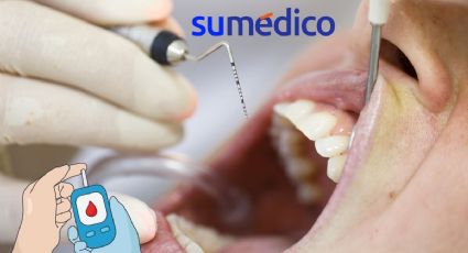 ¿Por qué la periodontitis avanzada aumenta el riesgo de diabetes?