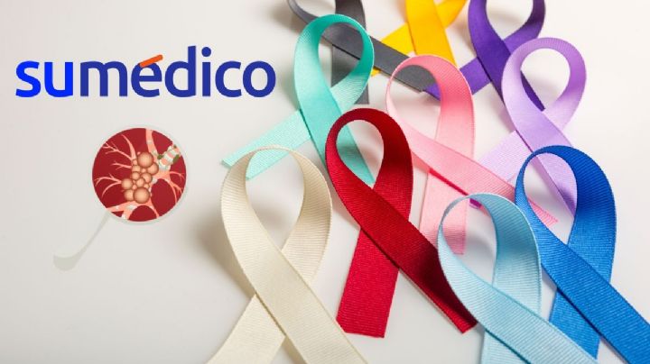 Cáncer de mama, próstata y colorrectal: los más frecuentes en mexicanos
