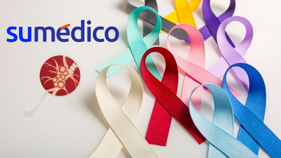 ¿Qué necesitamos para mejorar el tratamiento y diagnóstico de cáncer? Esto dicen especialistas.