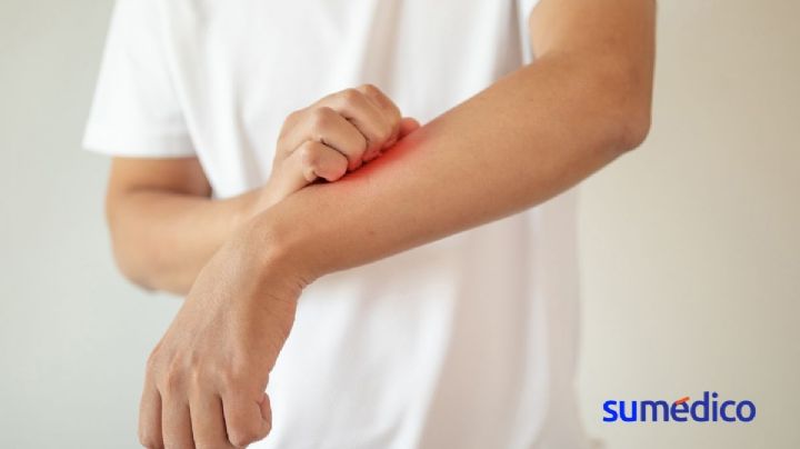 Este es el síntoma de cáncer poco mencionado que debes conocer
