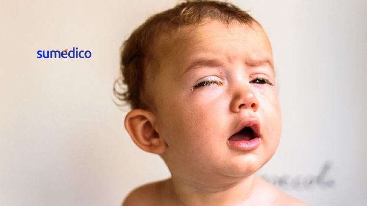 ¿Cómo eliminar las lagañas de los bebés y por qué salen?