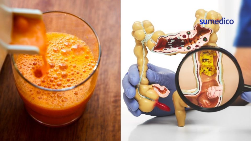 El jugo de zanahoria puede ser un aliado contra las enfemedades del colon.