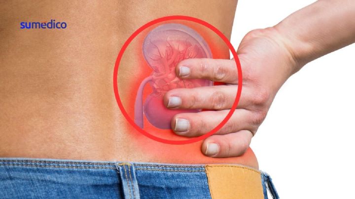 7 hábitos que más dañan los riñones ¿Los haces?