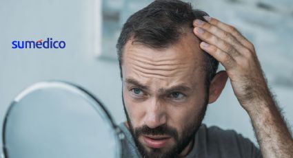 Remedios que debes seguir si estás perdiendo cabello