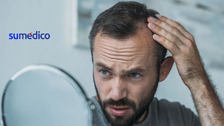 Remedios que debes seguir si estás perdiendo cabello