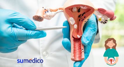 Nuevo tratamiento contra cáncer cervicouterino reduce riesgo de muerte en un 40%