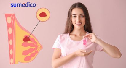 El cáncer de mama ha aumentado entre las mujeres jóvenes: estudio