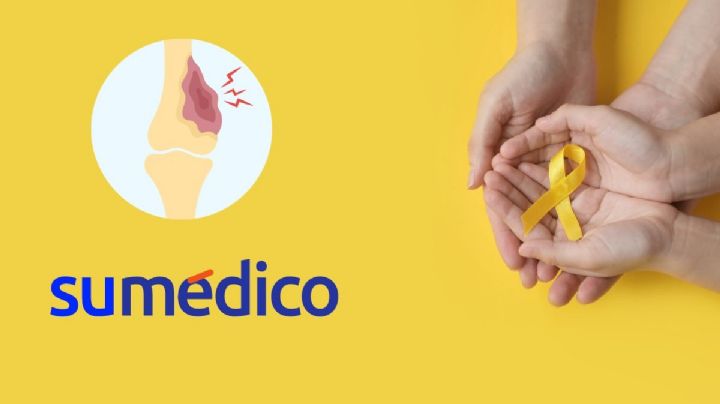 Mujer presentó un dolor muscular que resultó ser cáncer óseo