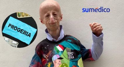 ¿Qué es la progeria, enfermedad que padecía Sammy Basso?