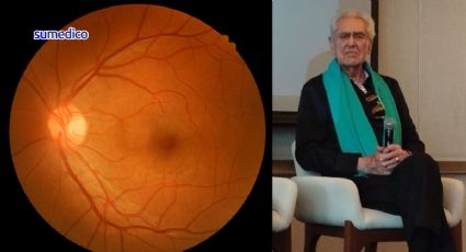 Así detectó Eric del Castillo que tenía degeneración macular: “Veía manchas raras”