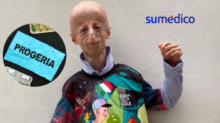 ¿Qué es la progeria, enfermedad que padecía Sammy Basso?