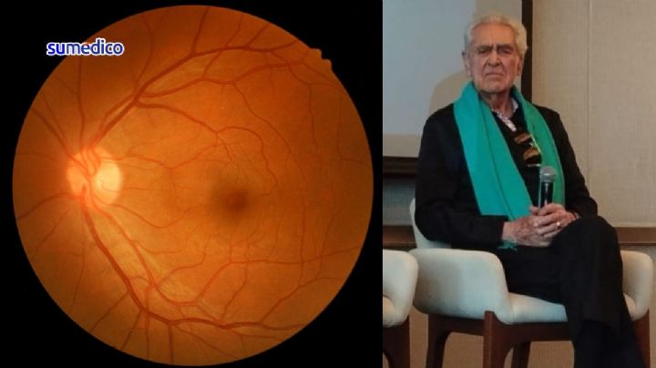 Así detectó Eric del Castillo que tenía degeneración macular: “Veía manchas raras”
