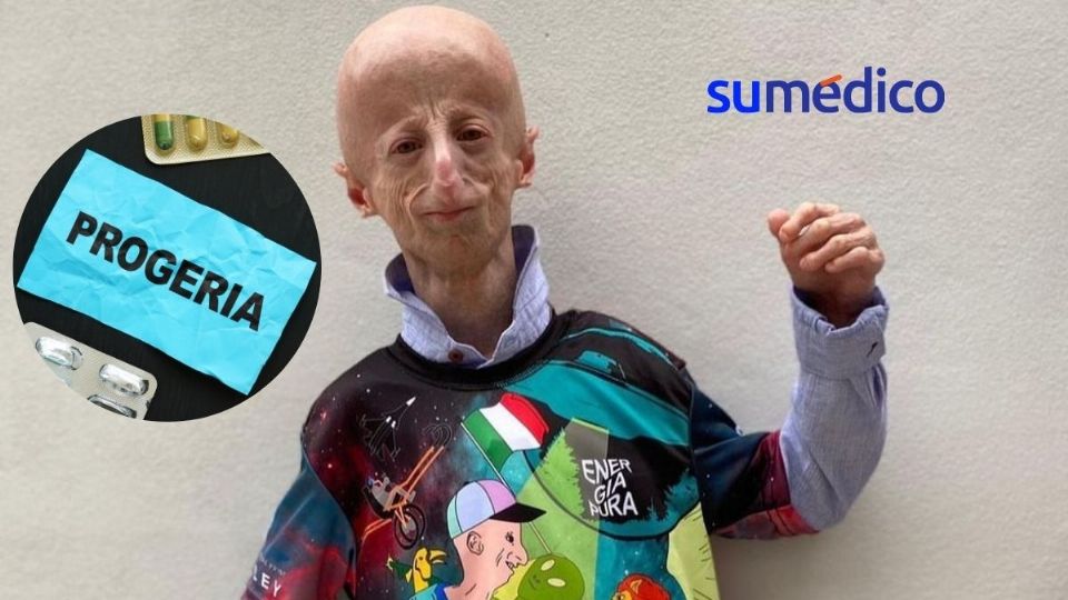 Sammy Basso murió a los 28 años a causa de la enfermedad progeria