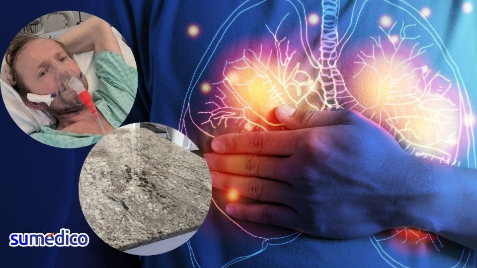 Marek es un hombre de 48 años que sufre silicosis a causa de las encimeras de mármol.