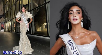 ¿Qué es el vitiligo que tiene la aspirante a Miss Universo Logina Salah?