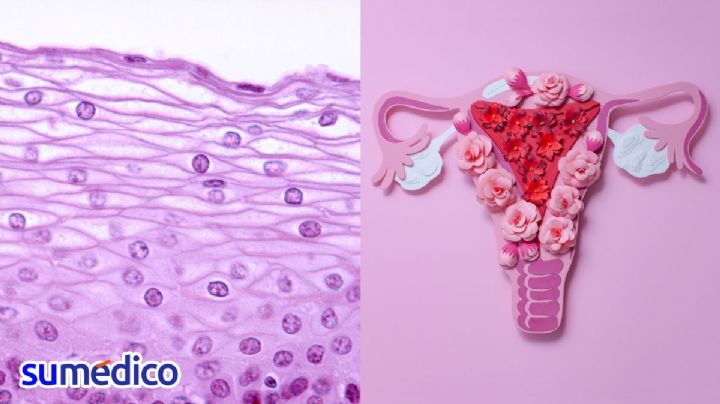 ¿Cómo se oculta el VPH en el cuerpo femenino?