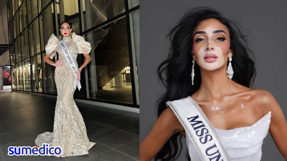 Logina Salah es la primera participante del certamen de belleza más importante del mundo con vitiligo