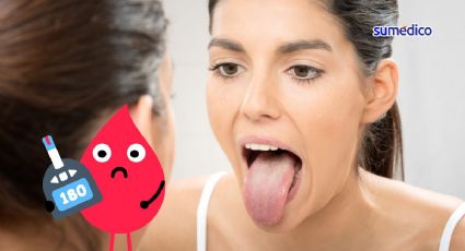 ¿Cómo se manifiesta la diabetes en la lengua?