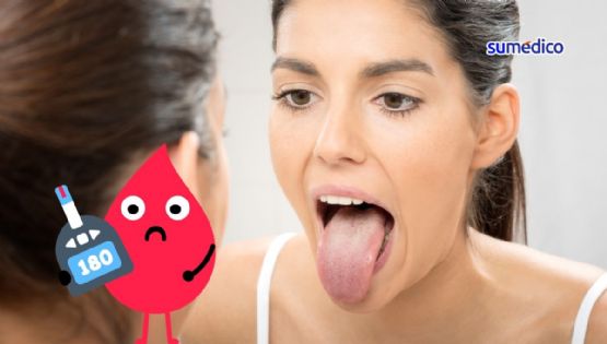 ¿Cómo se manifiesta la diabetes en la lengua?