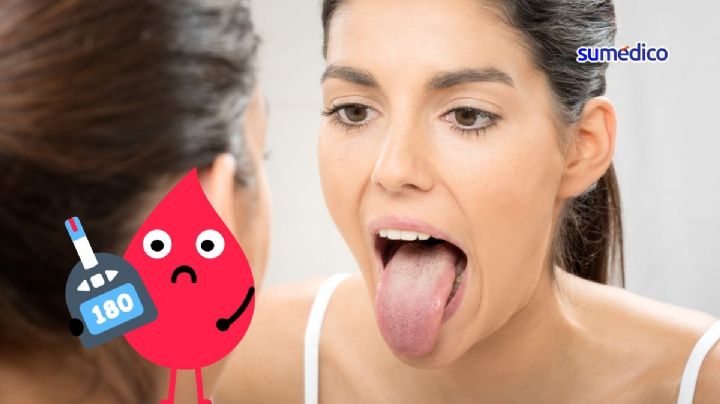 ¿Cómo se manifiesta la diabetes en la lengua?