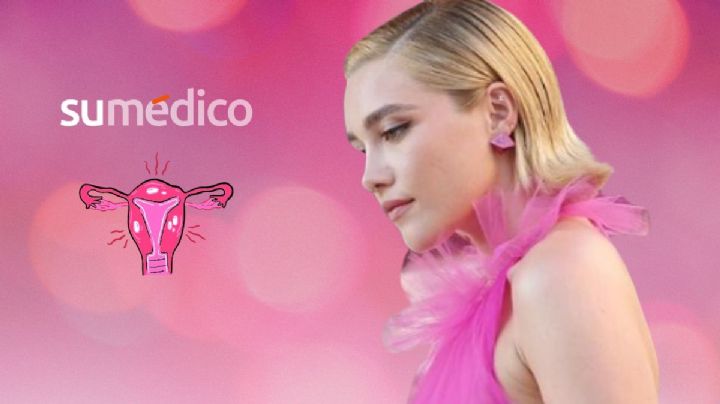 Endometriosis y SOP: el diagnóstico por el que Florence Pugh congeló sus óvulos