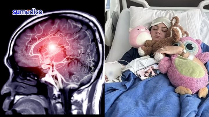 'Creí que era deficiencia de vitaminas o resaca, no pensé que tuviera un tumor'