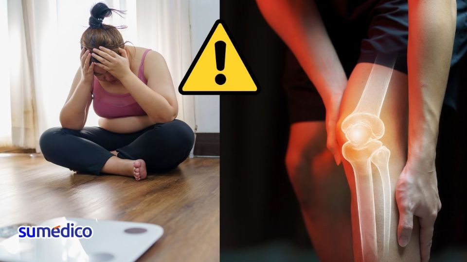 El dolor de rodilla que no se trata puede llevar a una osteoartritis.