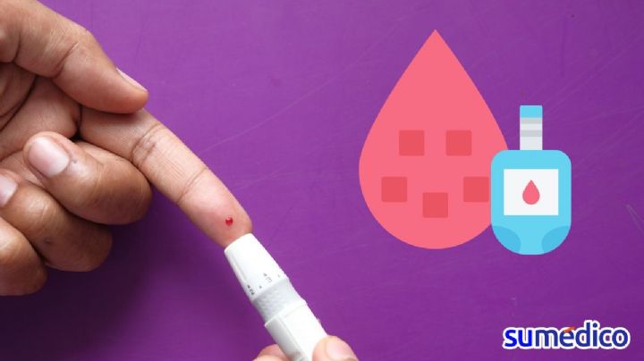 Diabetes: ¿Cómo saber si tus niveles de glucosa son demasiado altos?