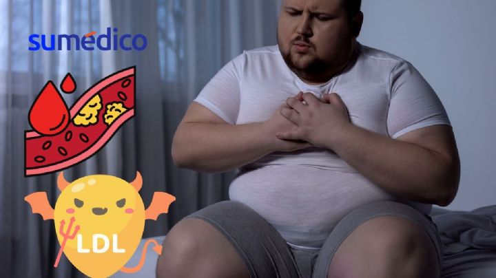 El fruto seco que debes consumir porque ayuda a controlar el colesterol
