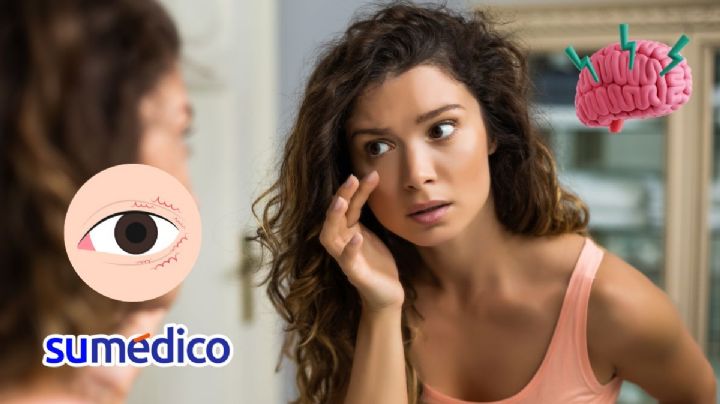 Cómo hacer que me deje de brincar el ojo, según oftalmólogos