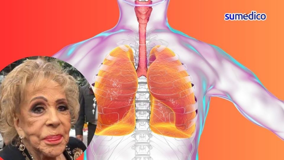 La salud de Silvia Pinal es delicada debido a un colapso pulmonar.