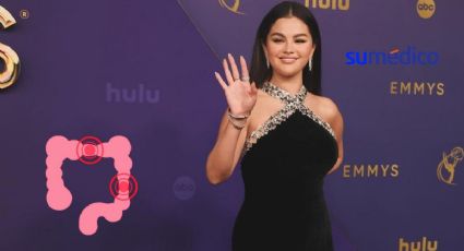 ¿Qué es el SIBO? Enfermedad que padece Selena Gomez