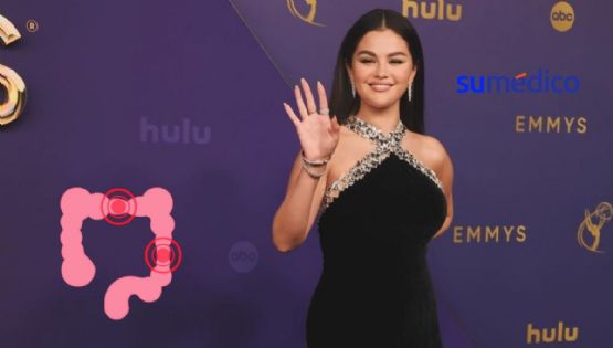 ¿Qué es el SIBO? Enfermedad que padece Selena Gomez