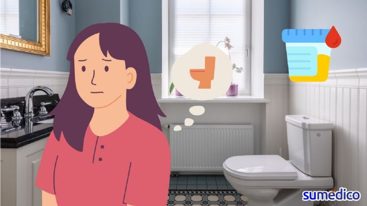 ¿Por qué aparece glucosa en la orina?