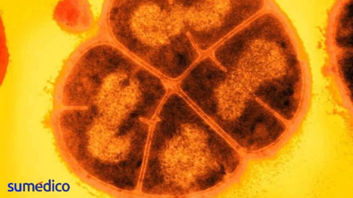 Conan, la bacteria que soporta la radiación extrema; así funciona