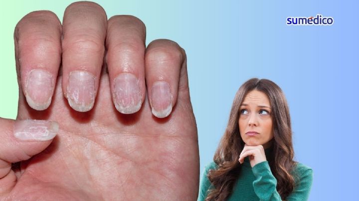 El significado de tener las uñas desarregladas, según la psicología