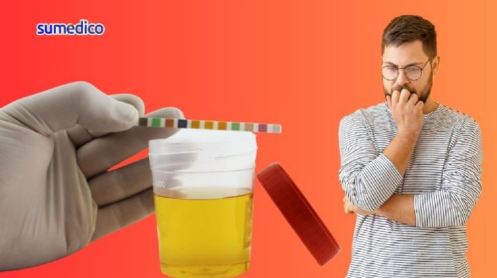 ¿Tu orina es de este color? Debes acudir al médico de inmediato