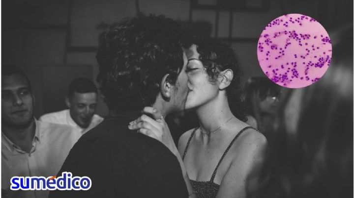 La peligrosa infección que pueden transmitir los besos en pareja