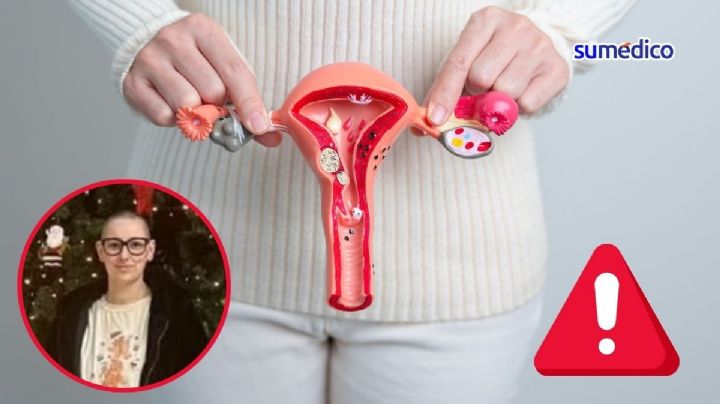 Los doctores dijeron que era una infección estomacal, pero era cáncer de ovario
