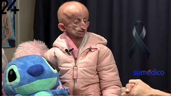 Muere la famosa tiktoker Beandri Booysen, ¿cuál era la terrible enfermedad que tenía?