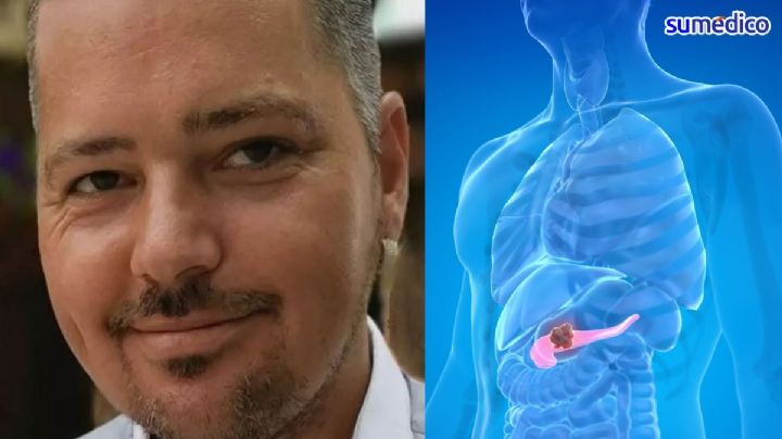 'Le dijeron a mi esposo que su dolor era ciática; murió de cáncer de páncreas poco después'