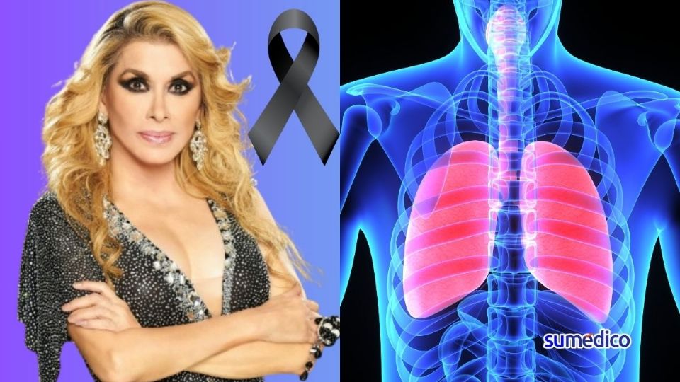 Dulce había tenido complicaciones pulmonares y renales.