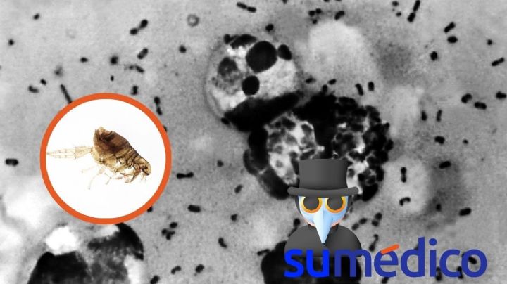 ¿Qué es la peste bubónica y qué síntomas da?