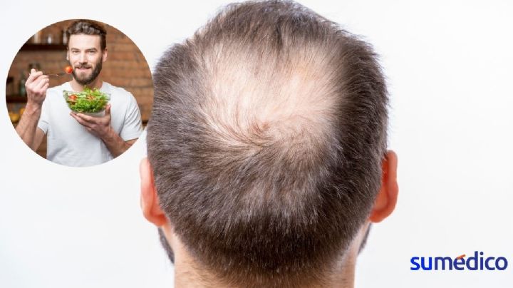 ¿Qué alimentos previenen la caída del cabello?
