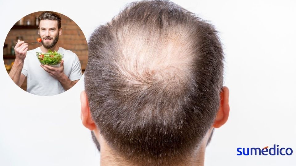 Descubre los alimentos que evitan la alopecia