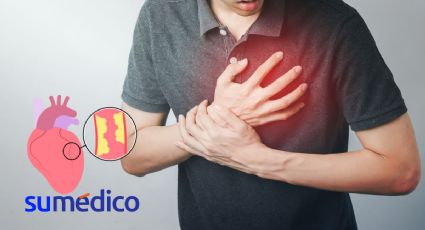 Estos signos atípicos podrían decirte si tienes una enfermedad cardiovascular