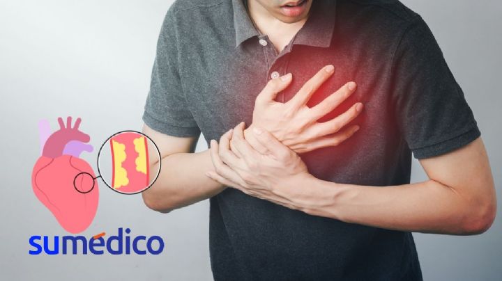 Estos signos atípicos podrían decirte si tienes una enfermedad cardiovascular