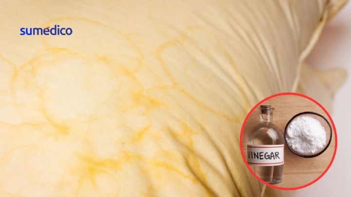 ¿Almohadas amarillas? Truco que usan los hoteles para blanquearlas