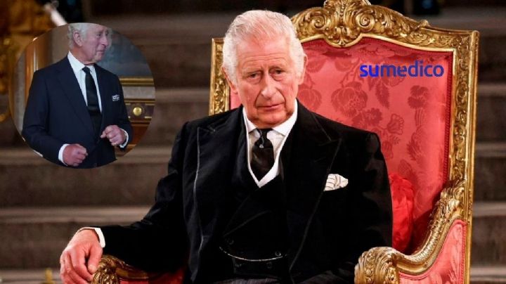 ¿Qué conexión tienen los dedos salchichas del Rey Carlos III con el cáncer que padece?